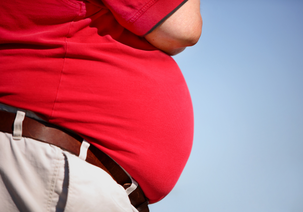 How obesity is costing the UK almost £30billion per year